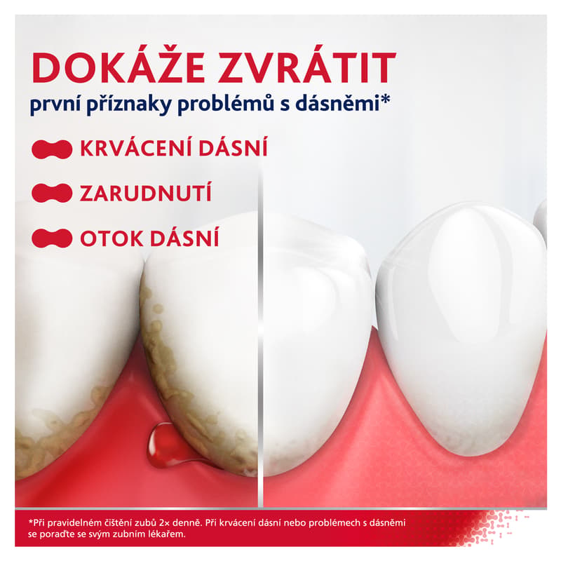 Parodontax Whitening Zubní pasta na paradentózu a bílé zuby