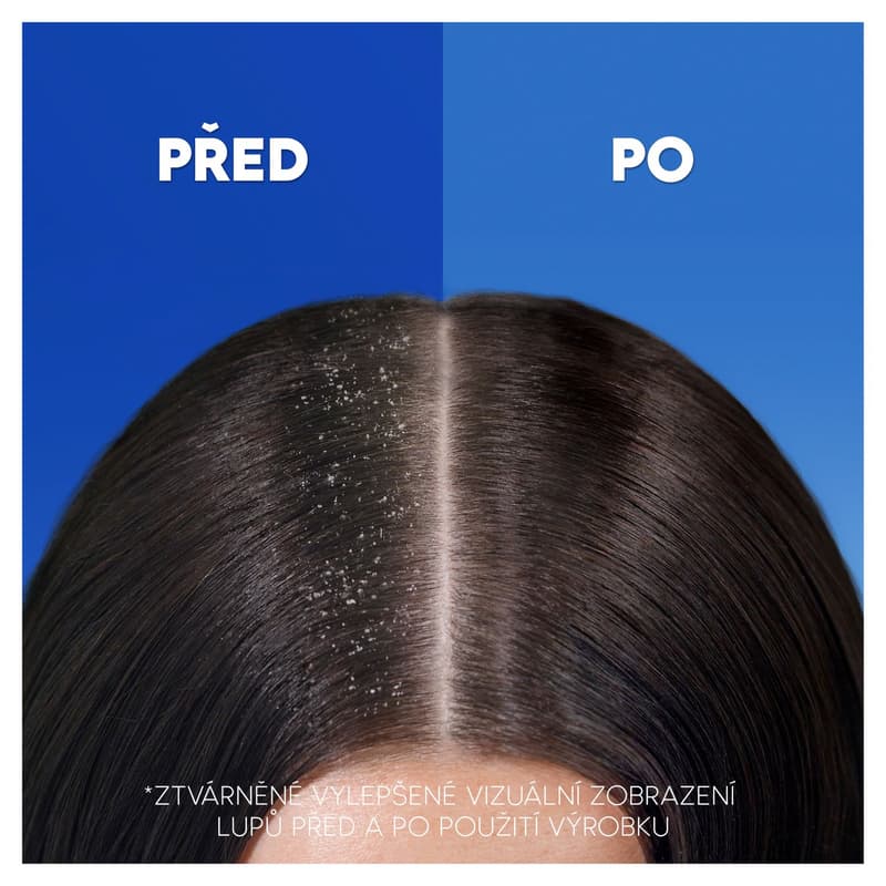 Head & Shoulders Citrus Fresh Shampoo