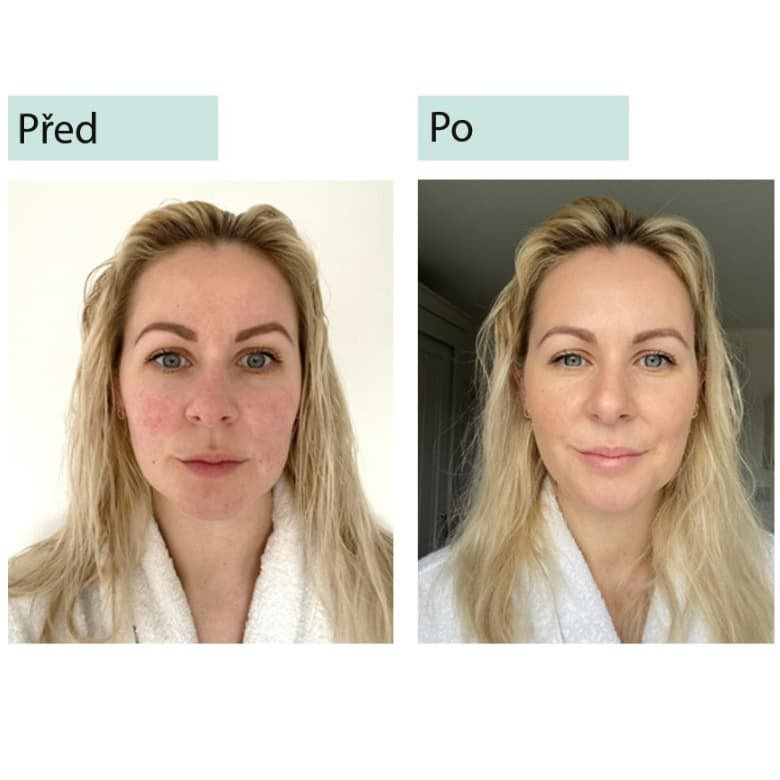 Sorted Skin Anti-Redness 5 in 1 Day Cream 30ml