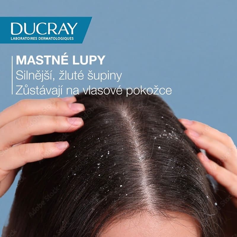DUCRAY Kelual Squanorm Šampon mastné lupy 200ml