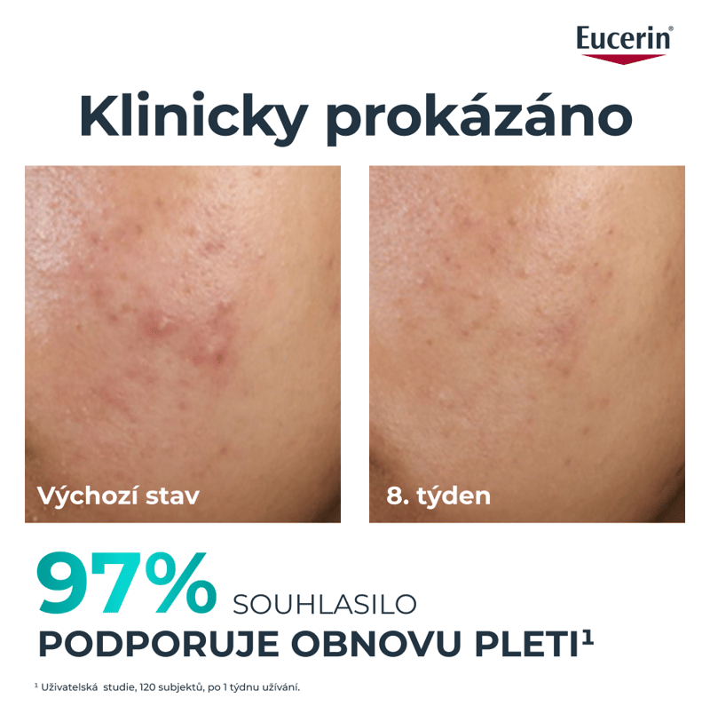 Eucerin DermoPure CLINICAL 10% peeling 40ml