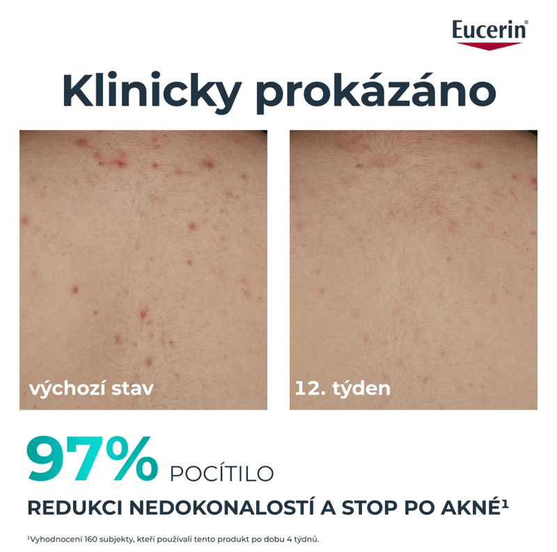 Eucerin DermoPure CLINICAL tělový krém 200ml