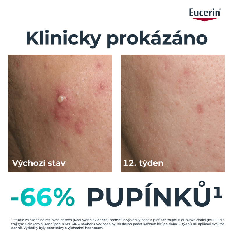 Eucerin DermoPure CLINICAL fluid s trojitým účinkem 40ml