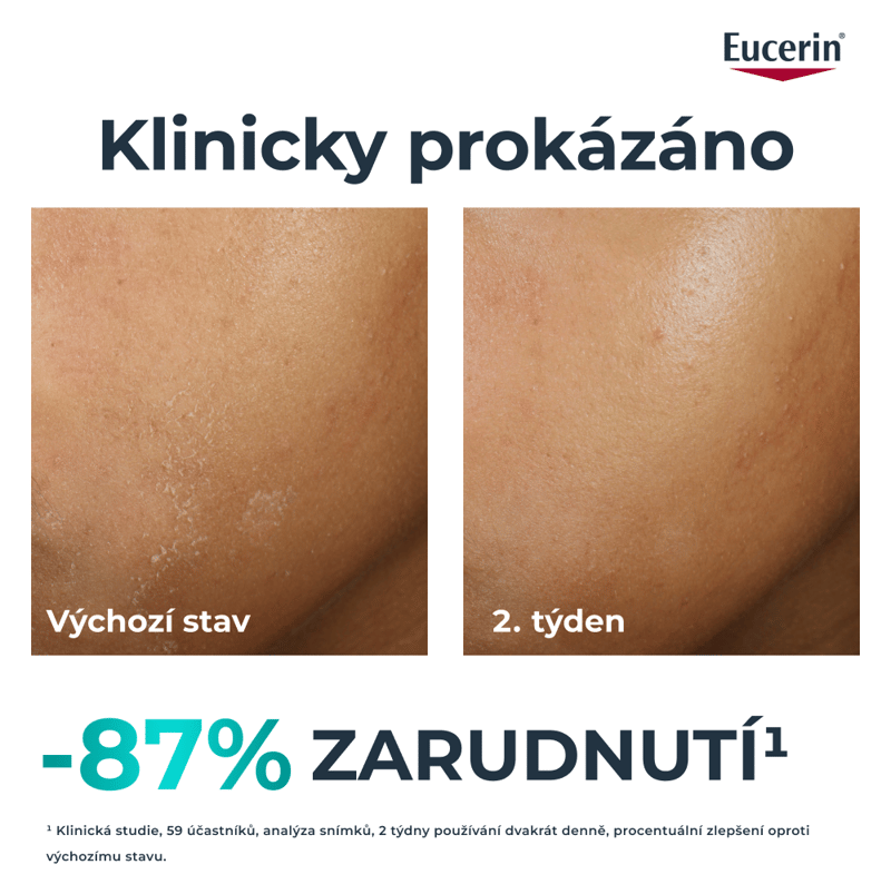 Eucerin DermoPure CLINICAL obnovující krém 40ml