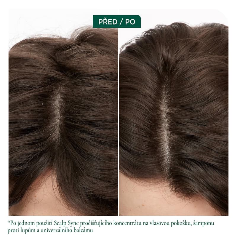 Biolage ScalpSync šampon proti lupům